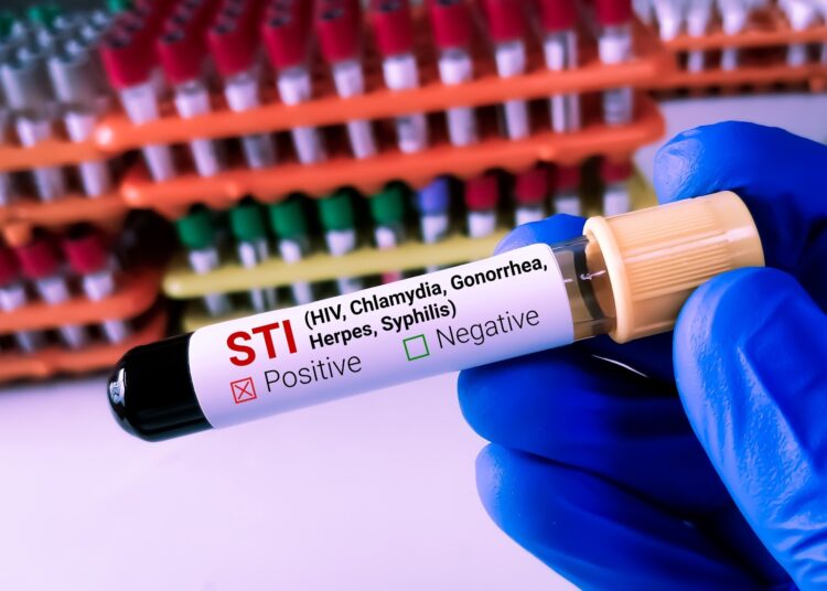 Lab Technologist holds Blood sample for STI