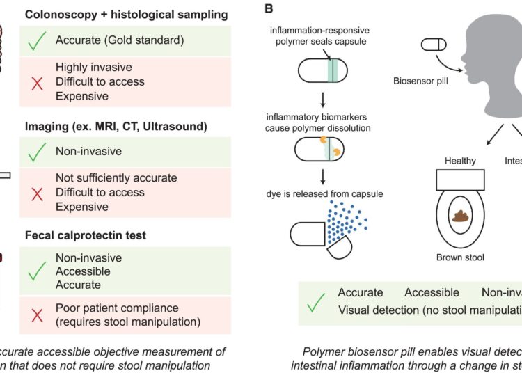 Schematic of modalities for inflammation monitoring in IBD. Study: A radically simple, ingestible colorimetric biosensor pill for cost-effective, non-invasive monitoring of intestinal inflammation