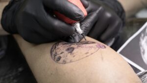 Tout savoir sur le détatouage laser : principe, précautions et résultats