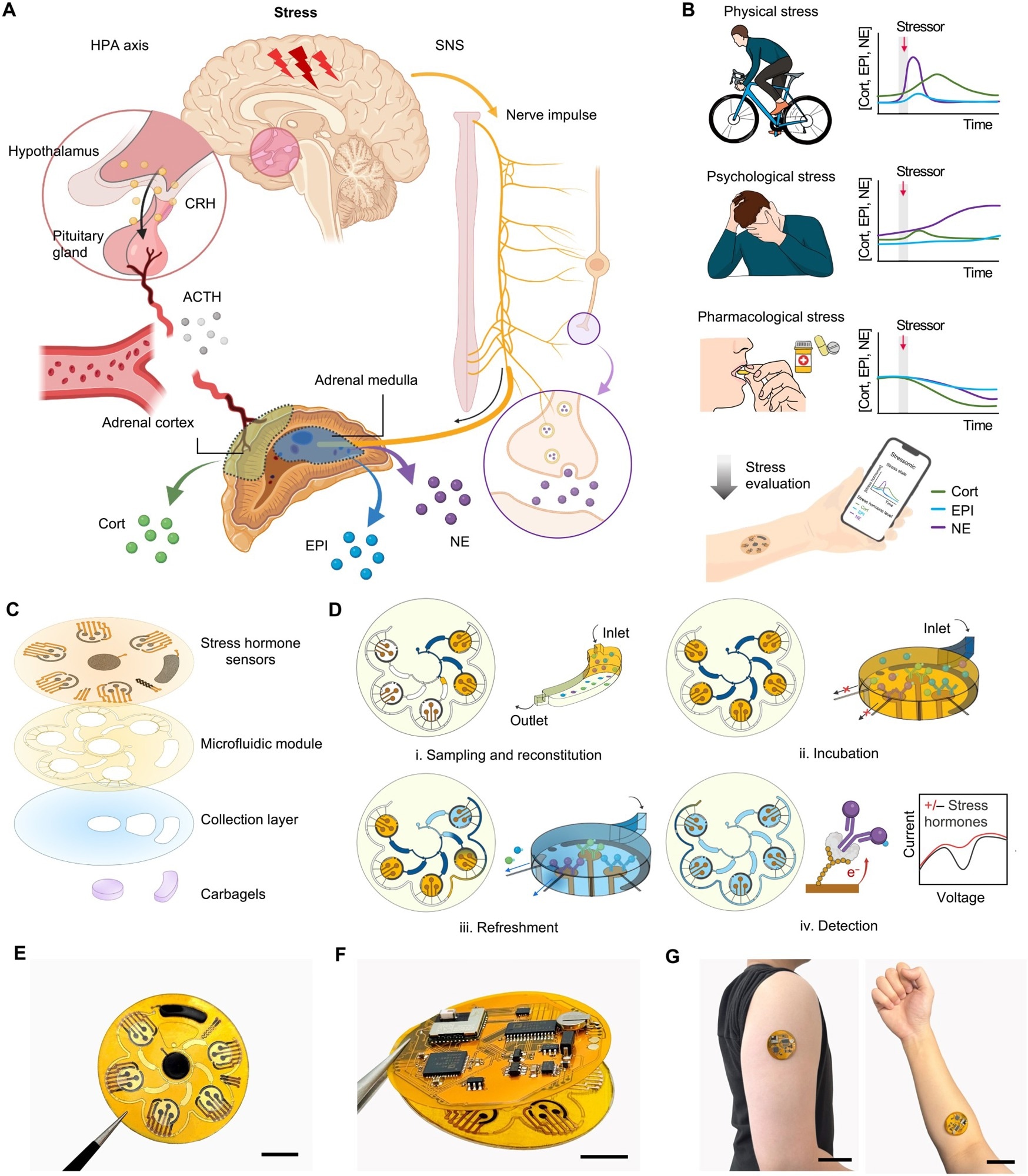 Aperçu de Stressomic, un système de surveillance des hormones de stress portable multiplexé. (A) Illustration schématique des voies de réponse au stress du corps. L'axe HPA déclenche le cortisol (CORT) libellé via l'hormone de libération de corticotrophine (CRH) et l'hormone adrénocorticotrope (ACTH), tandis que le SNS stimule la médulla surrénalienne pour libérer l'épinéphrine (EPI) et la non-congéphrine (NE) dans la circulation sanguine et la sécrétion de la NE lors des terres nerveuses. (B) Profils représentatifs des niveaux de CORT, EPI et NE sous stress physique (HIIT), stress émotionnel (IAP) et après modulation de stress (supplémentation). Ces données illustrent les exemple de tendances plutôt que la dynamique hormonale continue. (C) Conception de stressomique, composé de trois biocapteurs hormonaux, d'un module microfluidique pour l'échantillonnage séquentiel automatisé, de reconstitution et de livraison de réactifs, une couche de collecte qui facilite l'échantillonnage et l'accumulation de sueur et une paire d'hydrogels chargés de carbachol pour l'induction de la sueur à la demande. (D) le flux de travail du système microfluidique pour la détection des hormones de contrainte: (i) la sueur remplit les chambres réactifs et de détection, reconstituant les analytes dans le tampon avec des concurrents marqués à l'oxyde; (ii) les analytes incubent et rivalisent pour la liaison aux électrodes dans les chambres de détection; (iii) les molécules non liées sont rincées pour préserver la précision du capteur pendant les cycles de rafraîchissement automatisés; (iv) La détection électrochimique quantifie les hormones en mesurant les signaux redox, permettant une surveillance sensible et en temps réel. (E à G) Photos de stressomique, y compris le patch de capteur microfluidique (E), le système sans fil entièrement intégré (F) et un système porté sur le bras supérieur et l'avant-bras (G). Barres d'échelle, 1 cm (E et F) et 5 cm (g).