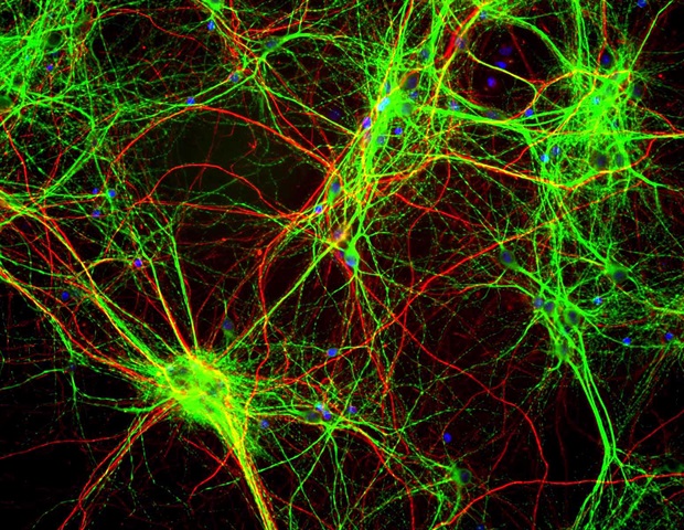 L'approche informatique donne un aperçu des cellules progénitrices neurales et de leur rôle dans les troubles du cerveau