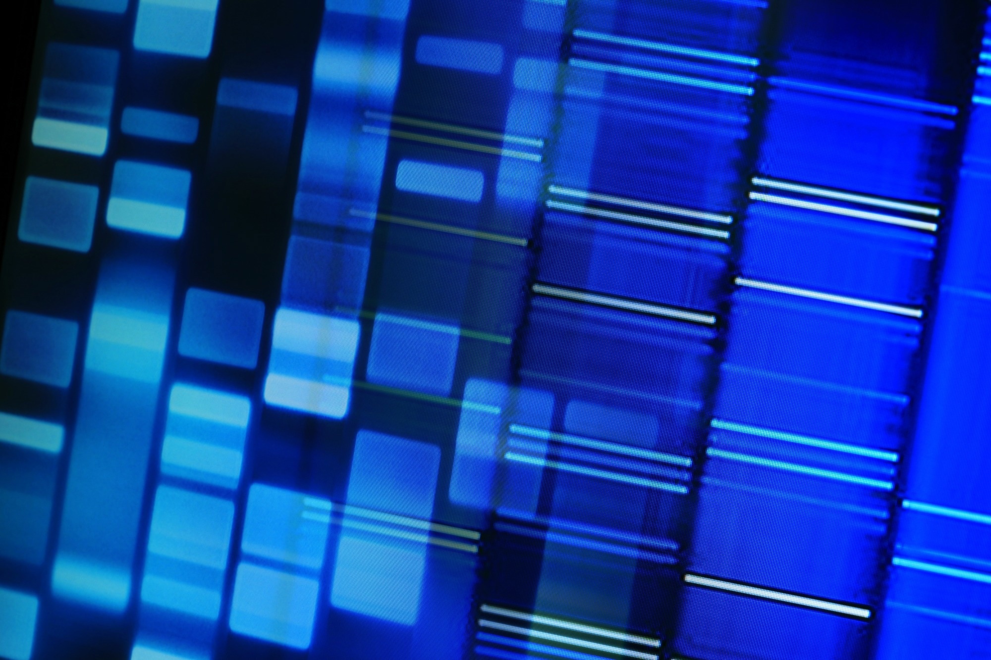 Study: Parent-of-origin effects on complex traits in up to 236,781 individuals. Image Credit: isak55 / Shutterstock