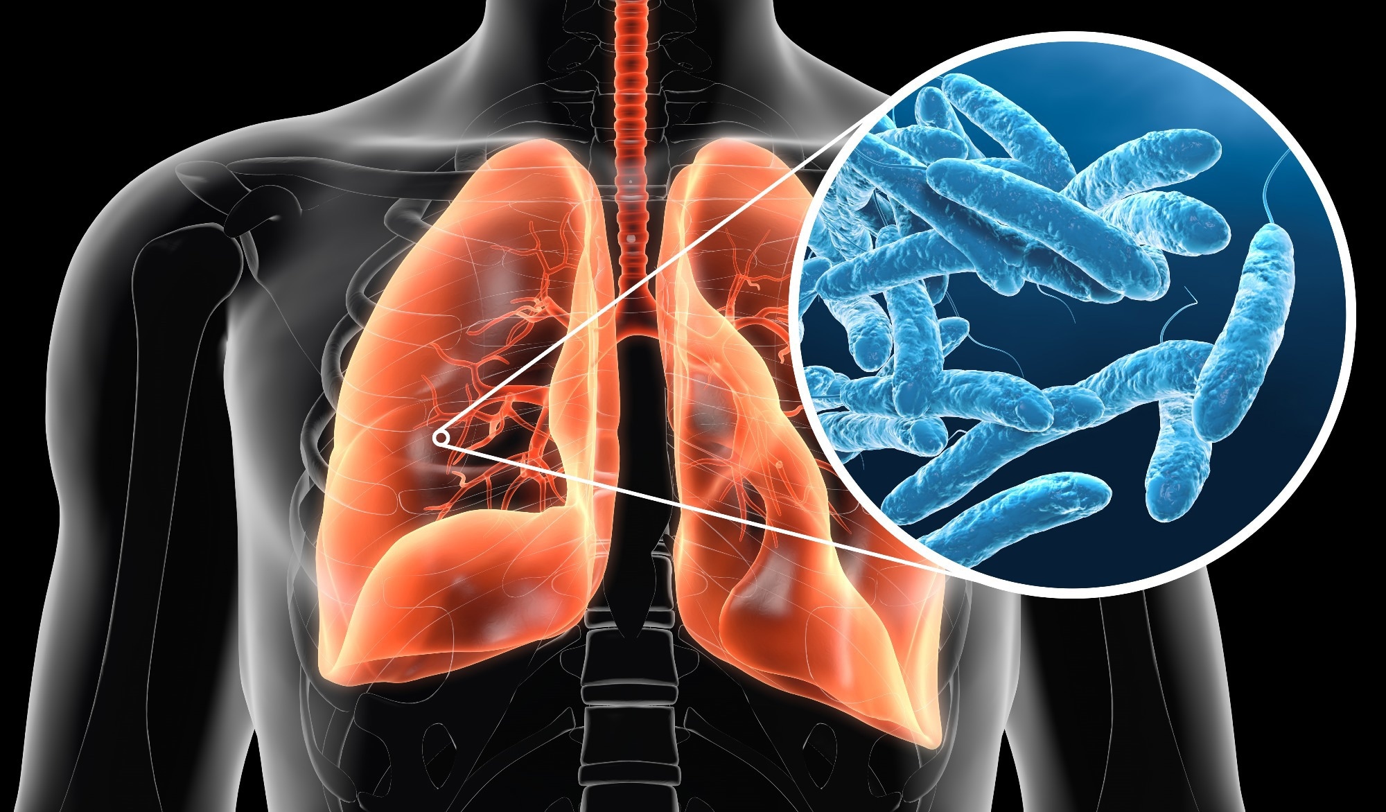 Study: Long-term impacts of Legionnaires’ disease on health and wellbeing: rationale, study design and baseline findings of a matched cohort study (LongLEGIO). Image Credit: Axel_Kock / Shutterstock