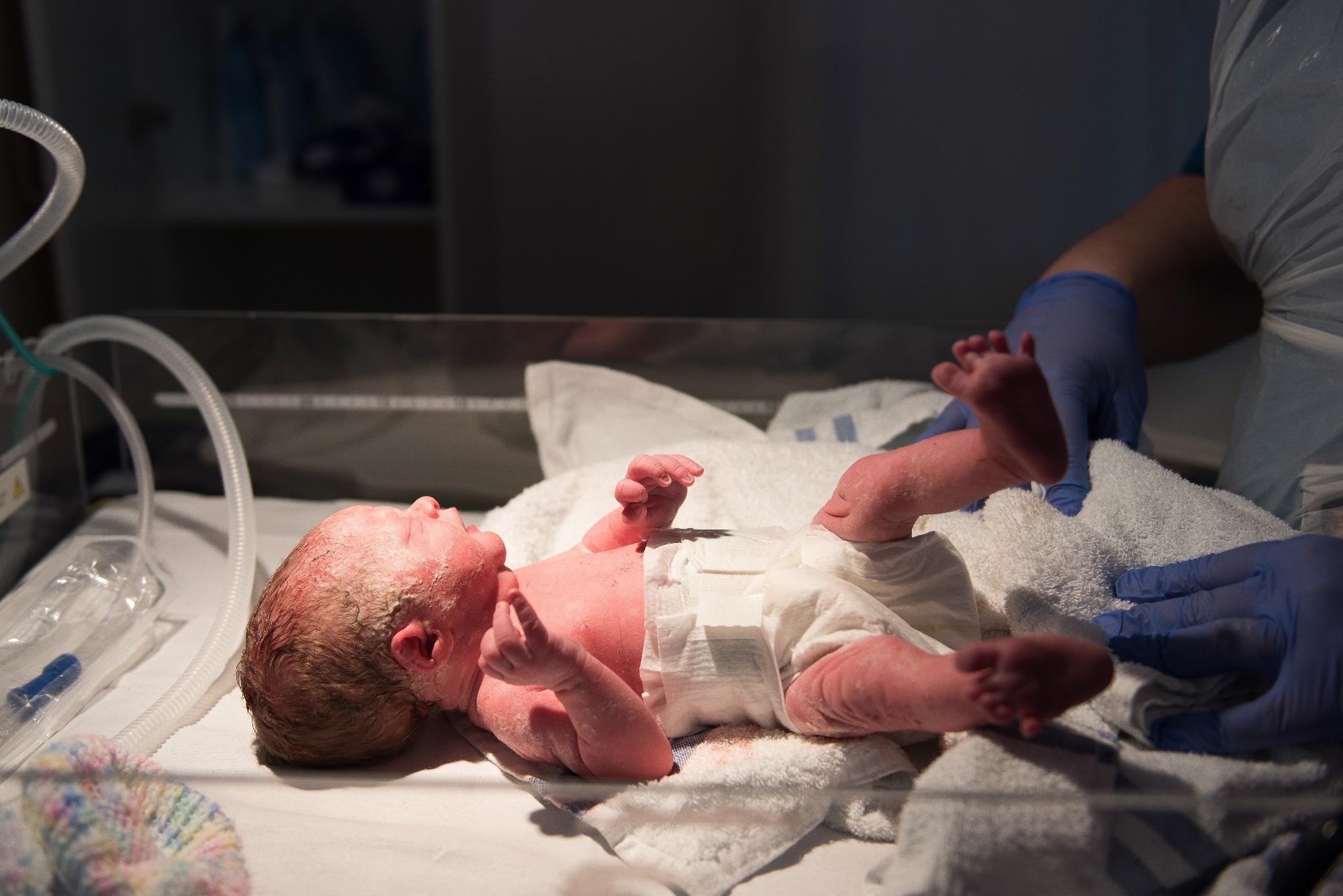 A young baby girl is born premature weighing just 4lbs, pictured here less than 5 minutes old
