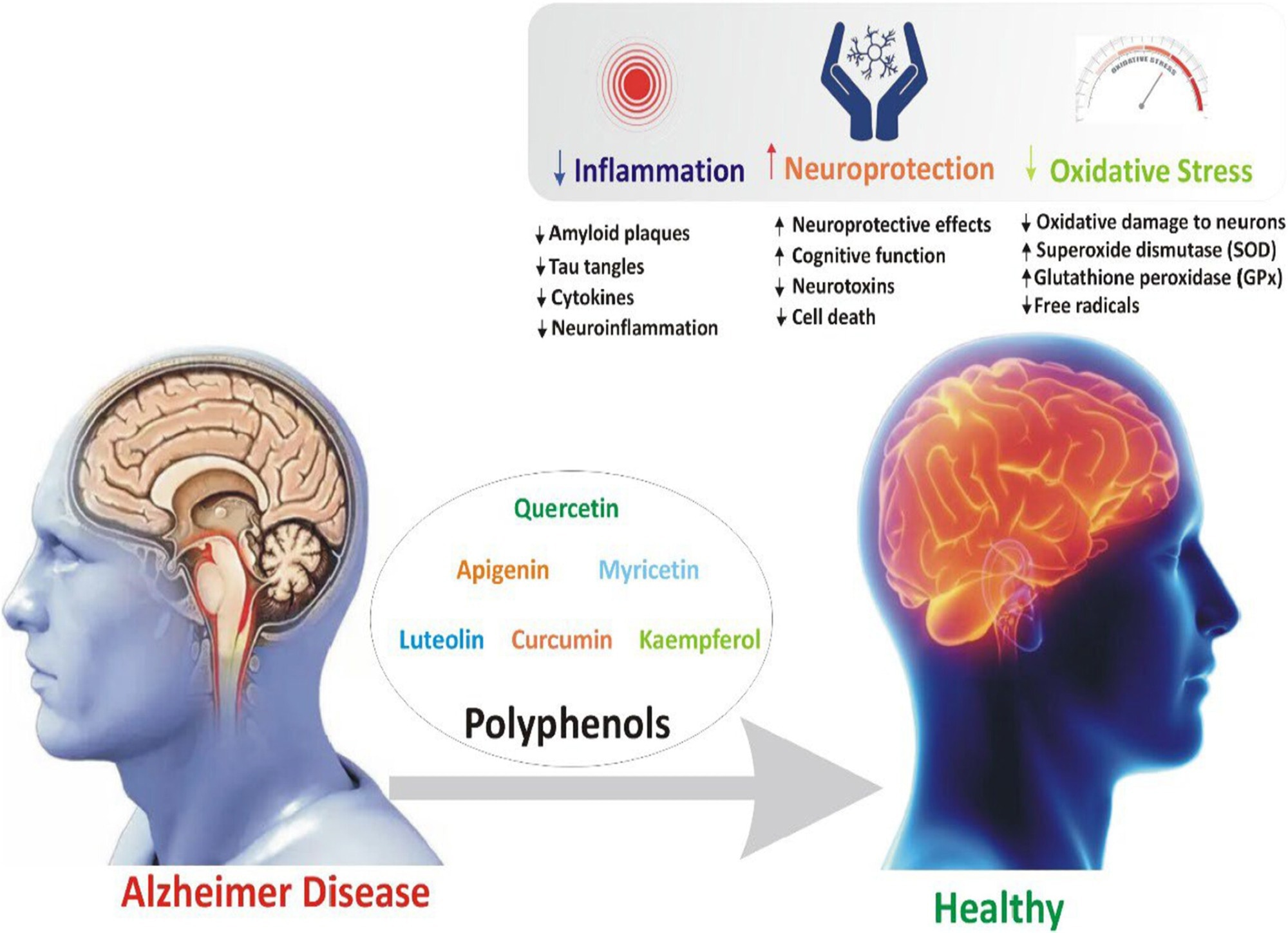 Review: Polyphenols and Alzheimer