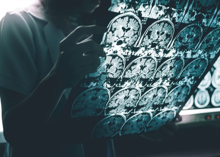 Study: Plasma Phosphorylated Tau 217 to Identify Preclinical Alzheimer Disease. Image Credit: Atthapon Raksthaput / Shutterstock
