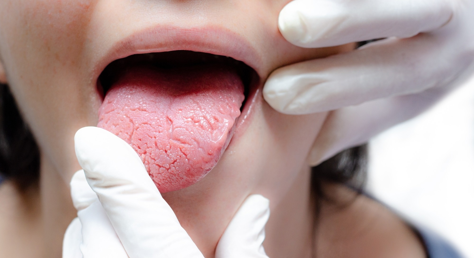 Tongue of a young Caucasian woman