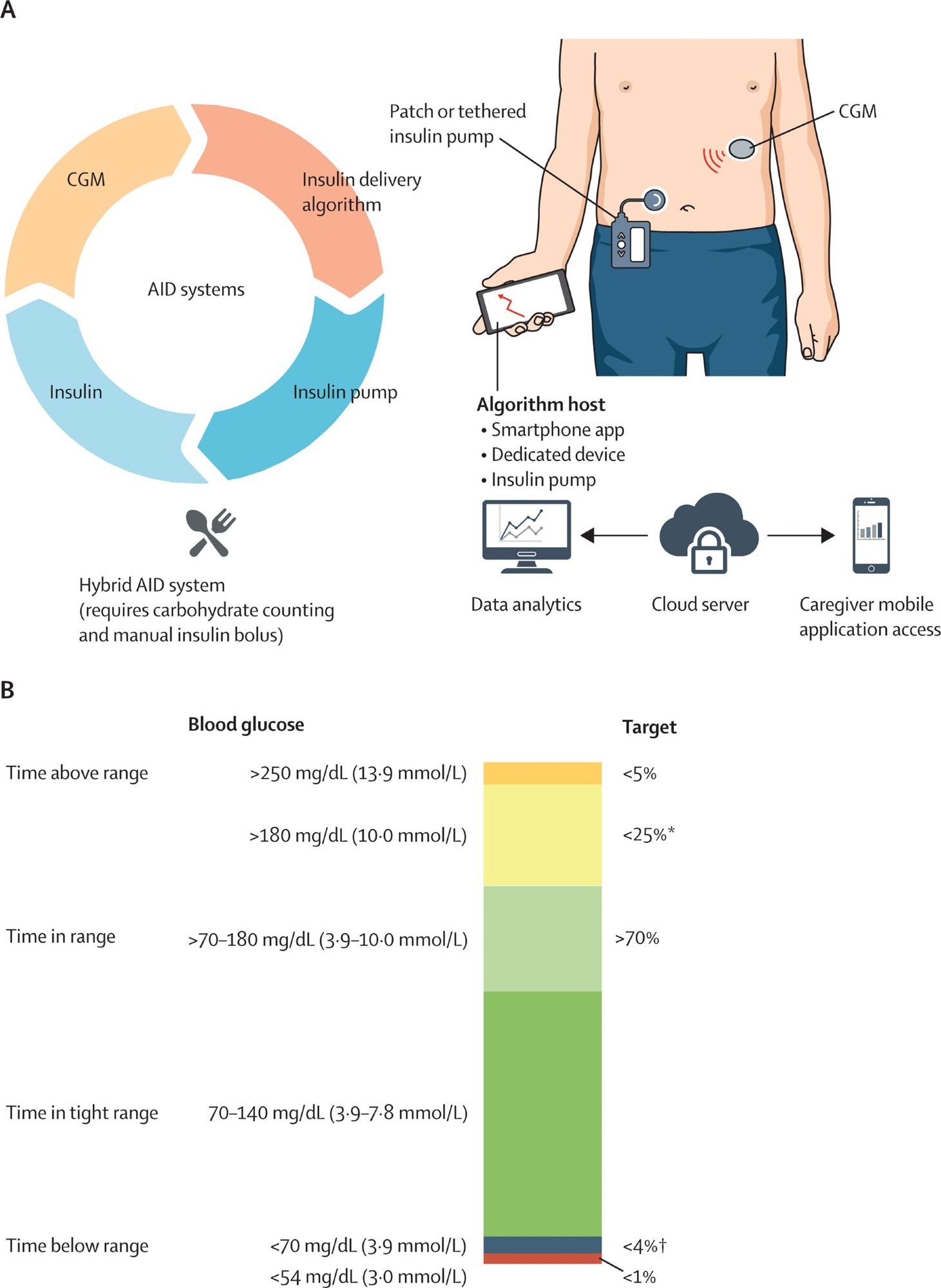 Systèmes d'aide et cibles de glycémie basés sur CGM (a) Système d'aide avec ses composants connectés. La dose d'insuline est calculée sur la base des valeurs de CGM à l'aide d'un algorithme d'administration d'insuline, et l'insuline est infusée par la pompe à perfusion d'insuline (attaché ou pompe à patch). Les systèmes à double hormone (enquête et non représentés sur la figure) infusent d'autres hormones telles que le glucagon en plus de l'insuline. L'aide hybride nécessite le comptage des glucides et les entrées de bolus de repas. Les données de livraison de CGM et d'insuline sont téléchargées sur le serveur cloud pour l'analyse des données et peuvent être accessibles par les parents, les soignants et les cliniciens de diabète. (B) Pourcentage de lectures et temps par jour dans la plage de glucose cible, temps inférieur à la plage de glucose cible, temps au-dessus de la plage de glucose cible et temps dans la plage serrée.
