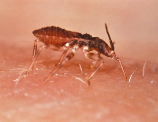 Sacubitril / Valsartan montre des avantages sur l'énalapril dans l'insuffisance cardiaque causée par la maladie de Chagas