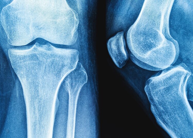 Review: Impact of yogurt consumption on bone health markers in adults with or without osteoporosis: a systematic review and meta-analysis. Image Credit: siamionau pavel / Shutterstock