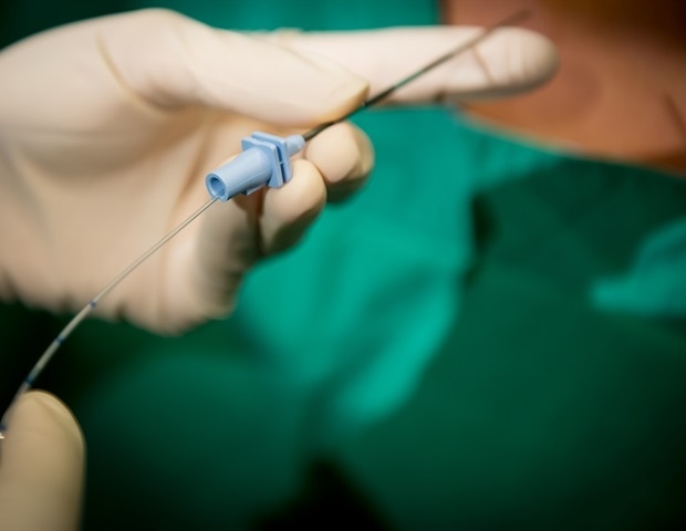 La stimulation péridurale et la rééducation physique peuvent améliorer la récupération chez les patients atteints de lésions médullaires