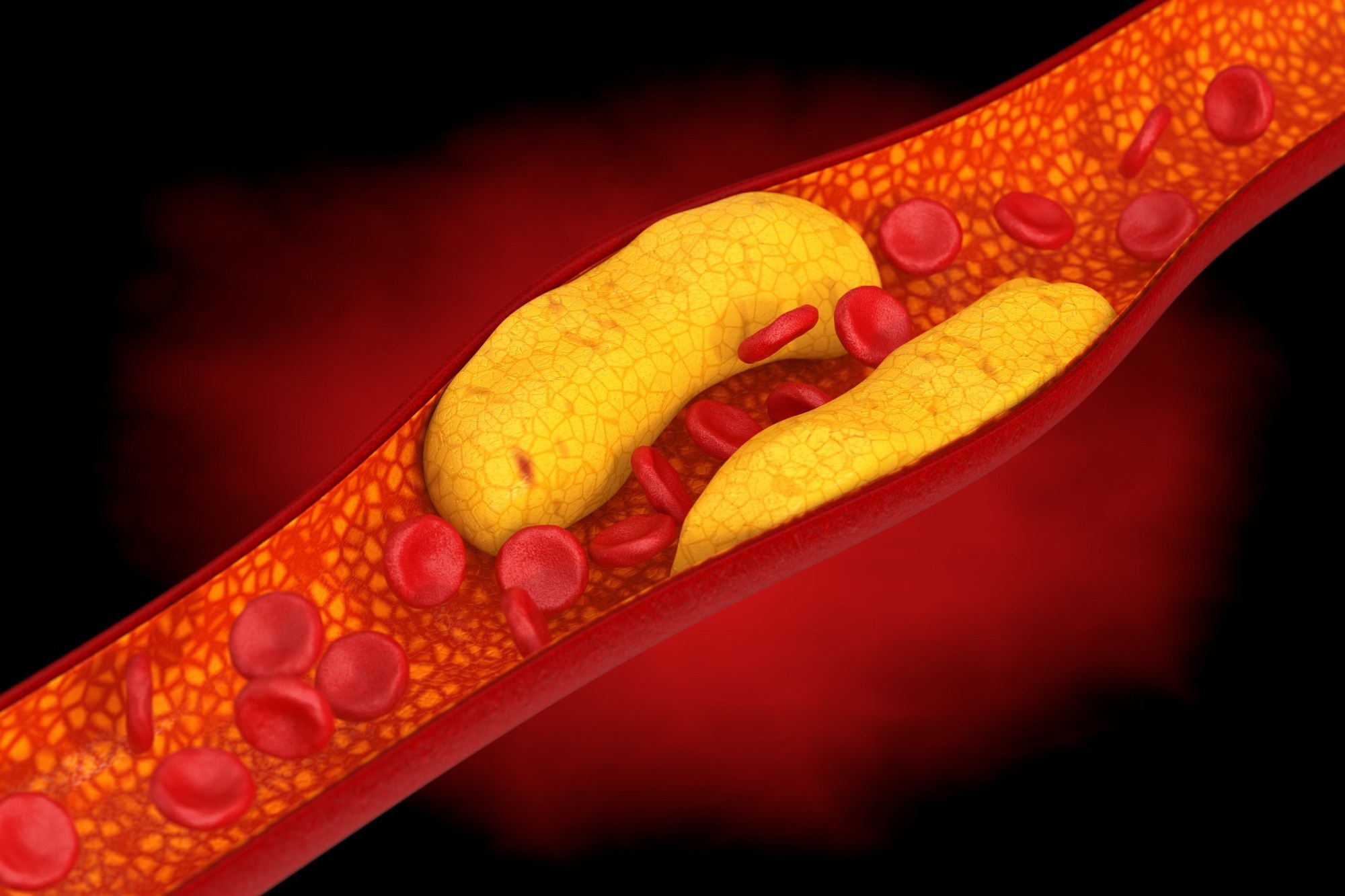 Study: Sex differences in the association of wearable accelerometer-derived physical activity with coronary heart disease incidence and mortality. Image Credit: doomu / Shutterstock