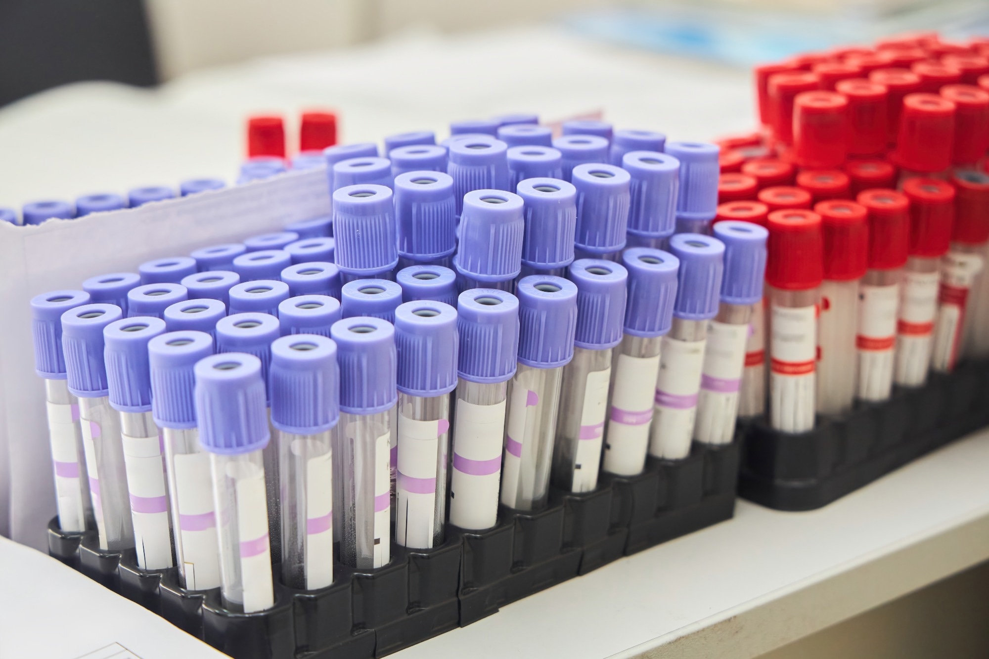 flasks for blood analysis