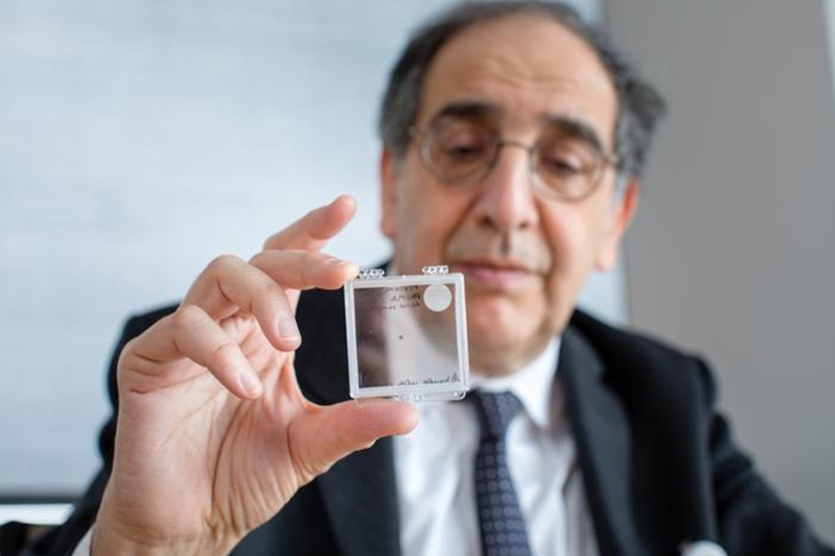 Un implant rétinien sans fil redonne la vue à des patients aveuglés par une dégénérescence maculaire avancée