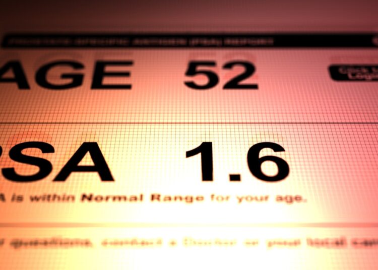 European Study of Prostate Cancer Screening  -  23-Year Follow-up. Image Credit: Joseph Kelly / Shutterstock