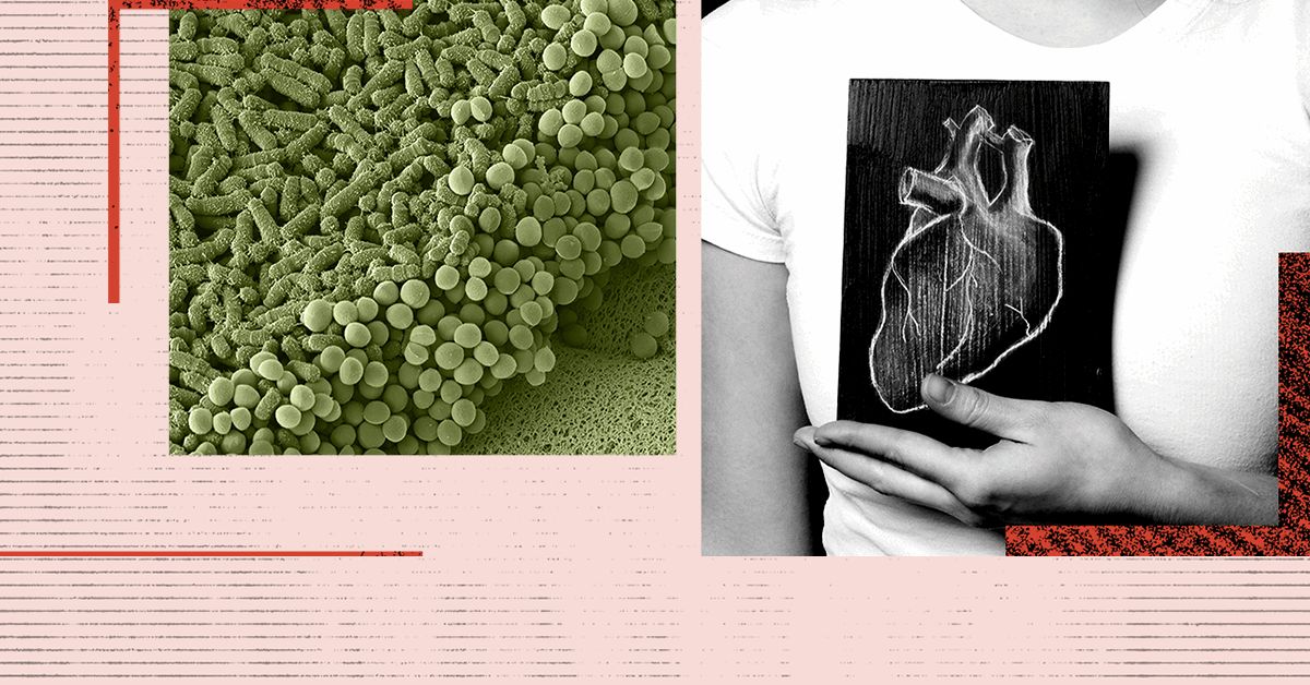 Les changements dans les bactéries intestinales peuvent être un signe avant-coureur d’une maladie cardiaque