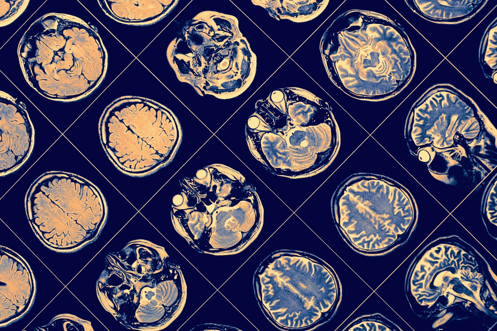 Study: Lymphoid gene expression supports neuroprotective microglia function. Image Credit: sfam_photo / Shutterstock
