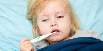 Les décès dus à la rougeole chutent mais les infections augmentent dans le monde