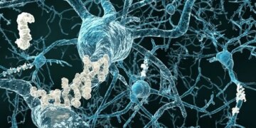 Un médicament expérimental cible l’amyloïde toxique précoce pour ralentir la maladie d’Alzheimer