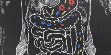 Les différences du microbiome distinguent les nourrissons prématurés atteints de cholestase associée à la nutrition parentérale