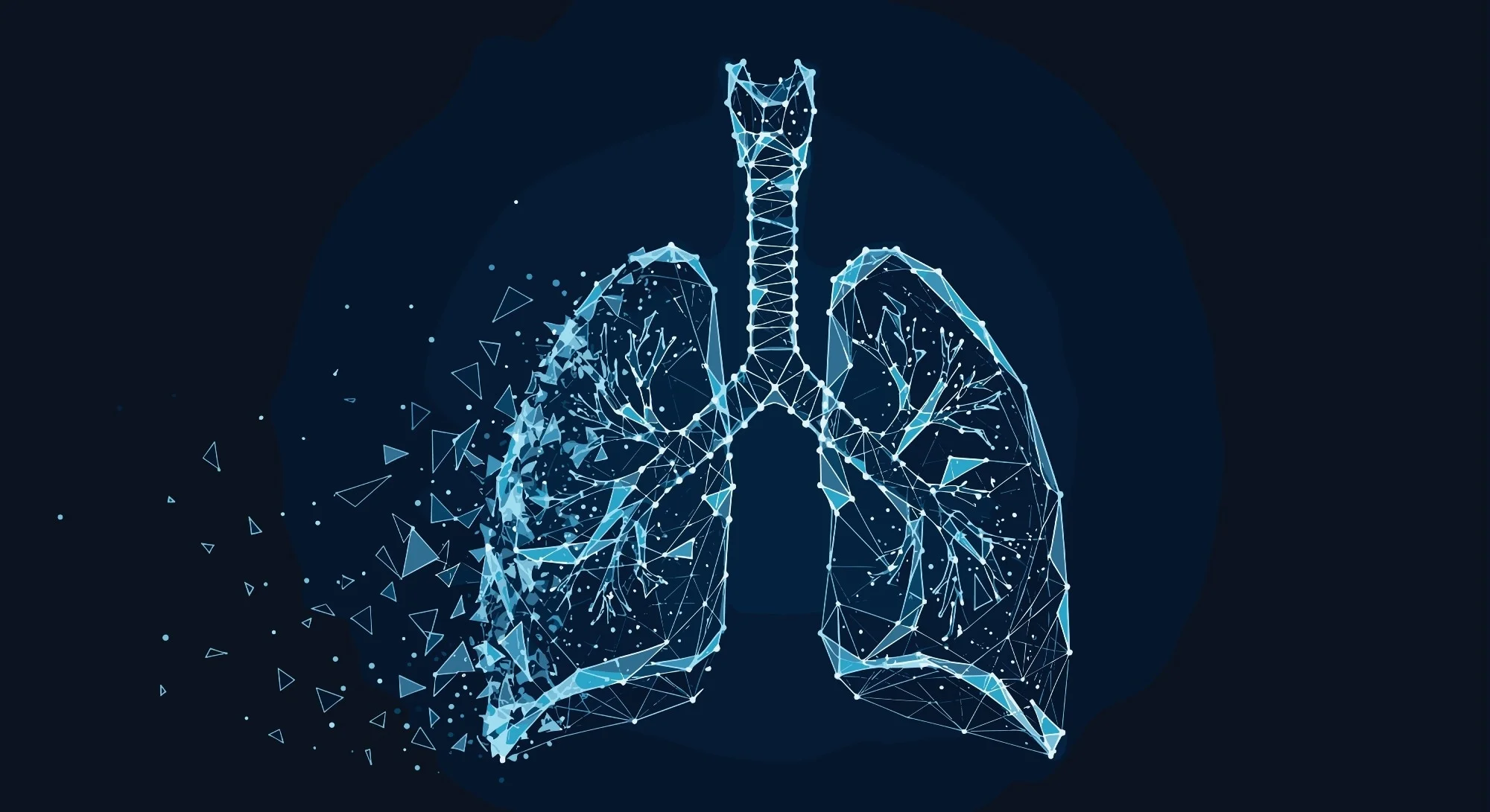 Lungs and trachea.