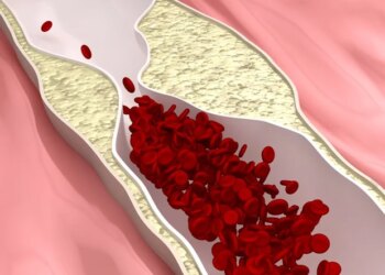 L'évolocumab réduit les événements cardiaques chez les patients diabétiques à haut risque