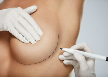 Comment l’augmentation mammaire peut-elle améliorer votre bien-être ?