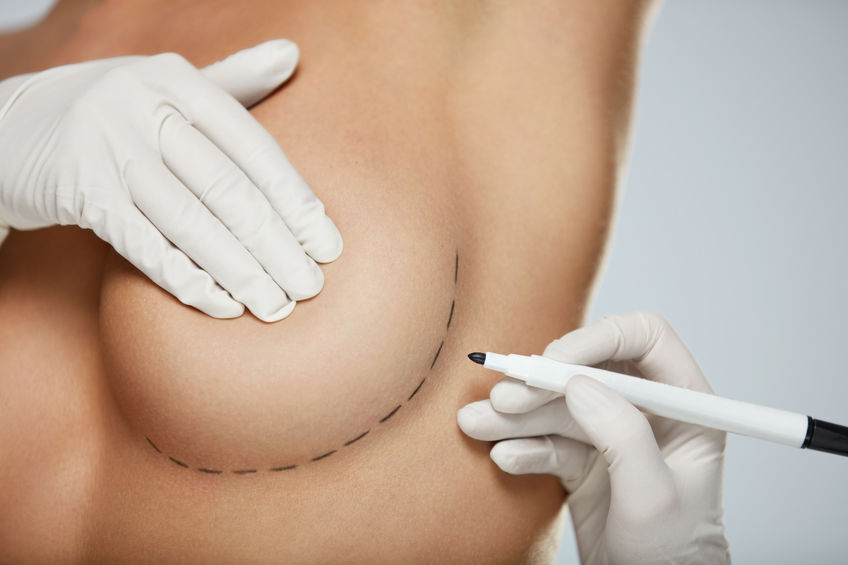 Comment l’augmentation mammaire peut-elle améliorer votre bien-être ?