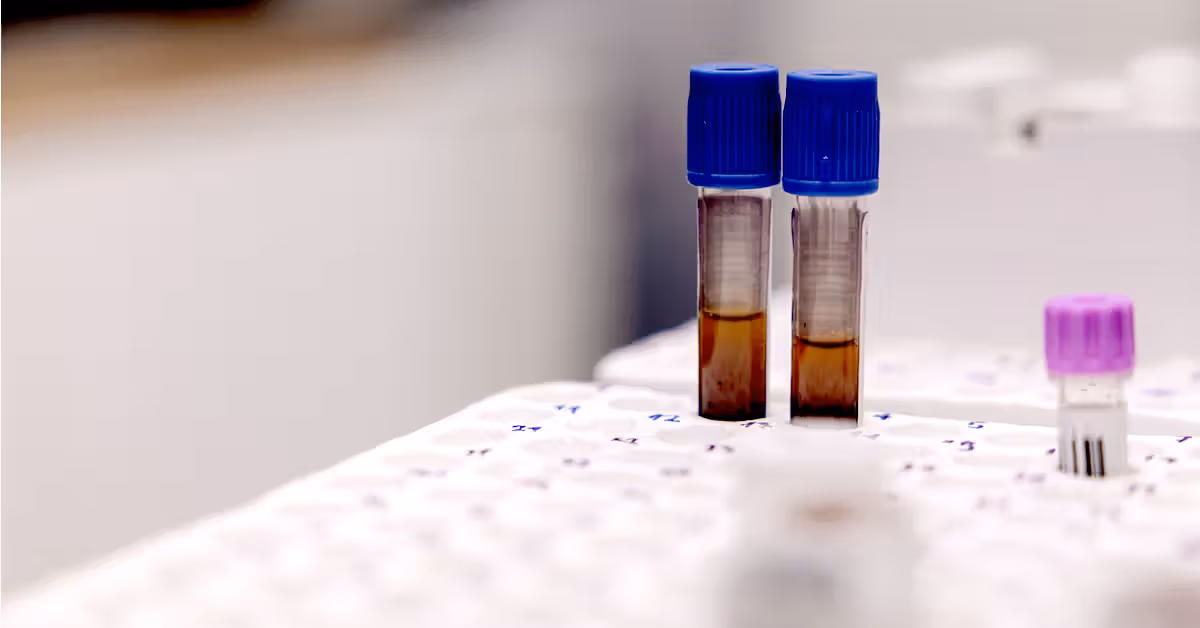 L’anémie pourrait-elle augmenter le risque de développer une démence ?