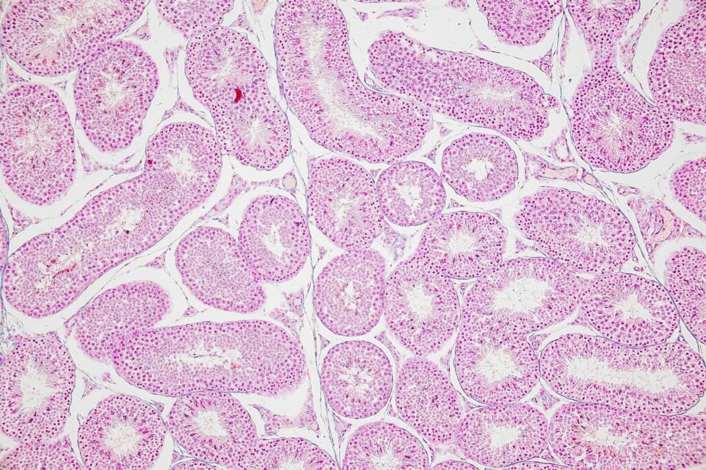Backgrounds of Characteristics Tissue of Ovary rabbit and Tissue of Testis mouse under microscope.