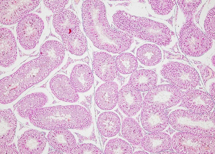 Backgrounds of Characteristics Tissue of Ovary rabbit and Tissue of Testis mouse under microscope.