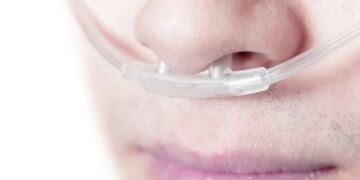 L'oxygénothérapie hyperbare présente un double effet dans le traitement du glioblastome
