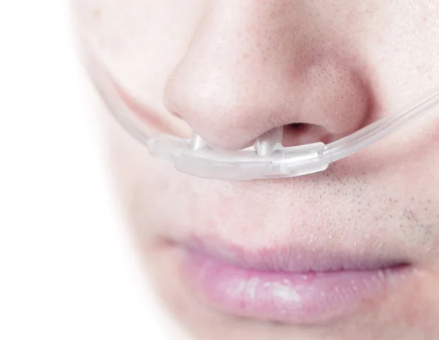 L'oxygénothérapie hyperbare présente un double effet dans le traitement du glioblastome