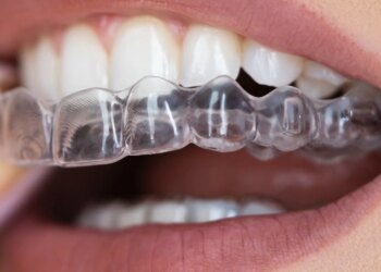 Study: The Changes of Microbiome Attached on Clear Aligners after Drinking Coca-Cola. Image Credit: Andrey_Popov / Shutterstock