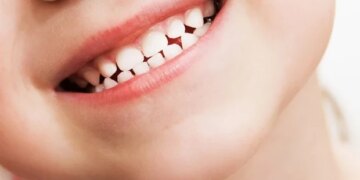 Les dents de lait révèlent les effets précoces d’une exposition aux métaux sur le cerveau