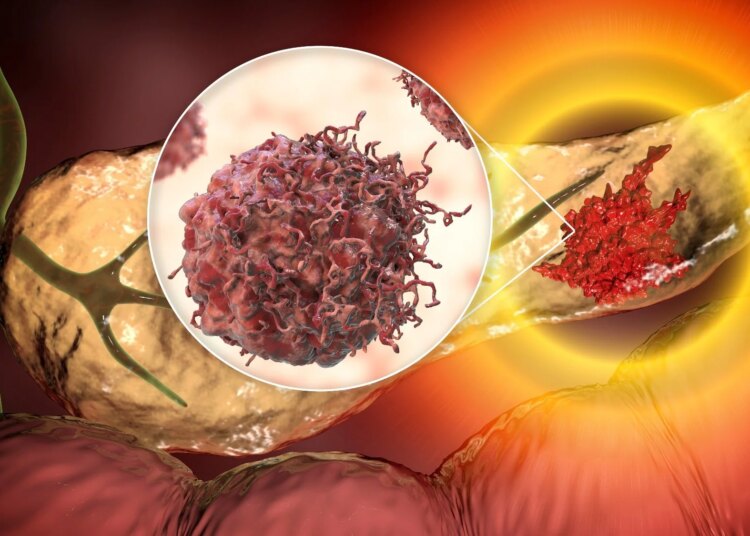 Research letter: Incidence, Mortality, and Federal Research Funding by Cancer Type in the US. Image Credit: Kateryna Kon / Shutterstock