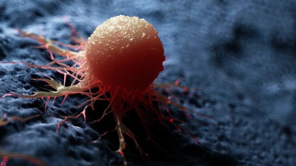 Un nouveau test sanguin détecte quatre cancers et d’autres maladies en éliminant le bruit sain de l’ADN