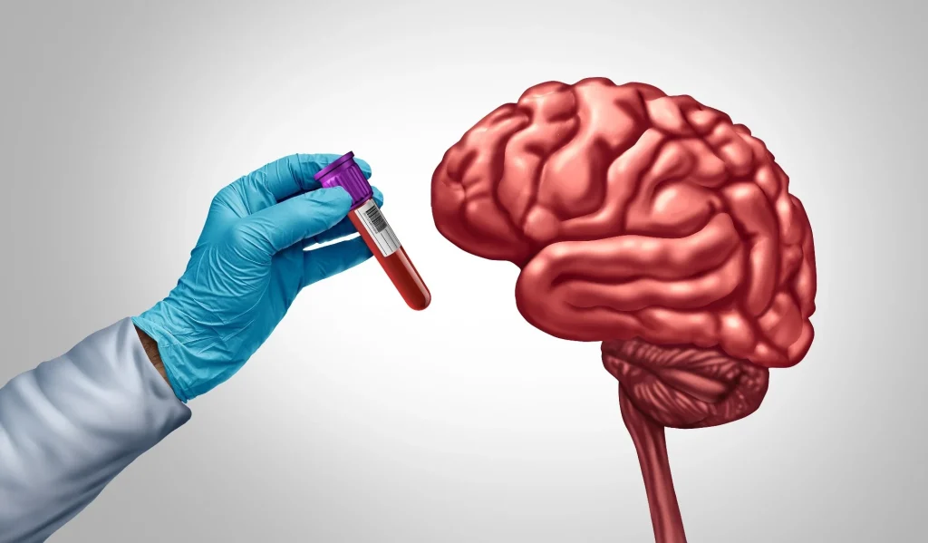 Study: Semaglutide attenuates a proteomics-based dementia risk signature in older adults with overweight or obesity and cardiovascular disease without diabetes: A post hoc analysis of the SELECT phase 3 trial. Image Credit: Lightspring / Shutterstock
