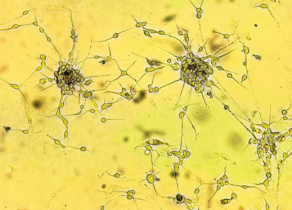 Spheroids of glioblastoma cell culture. Spheroidal structures of human malignant brain tumor cells under a microscope. Study: Cannabinoids suppress chemotherapy- and ionizing radiation-induced apoptosis of glioblastoma cells. Image Credit: Sergei Drozd / Shutterstock