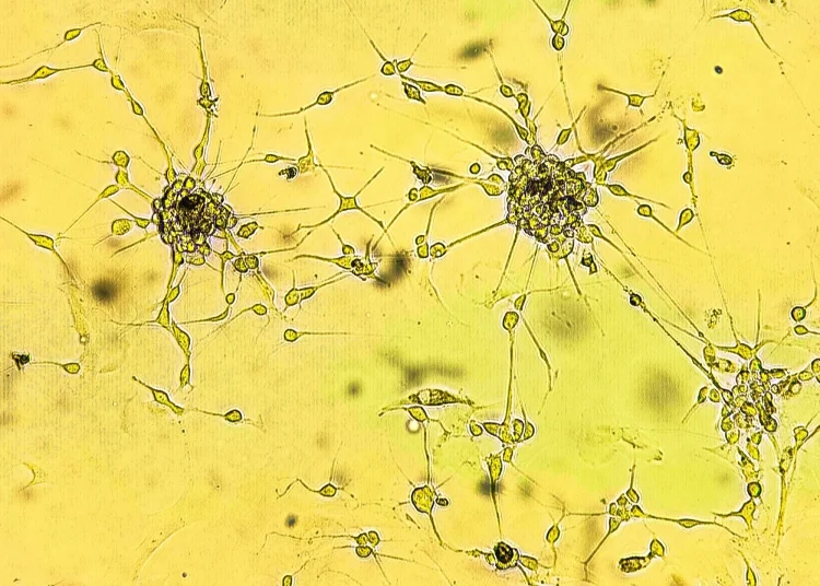 Spheroids of glioblastoma cell culture. Spheroidal structures of human malignant brain tumor cells under a microscope. Study: Cannabinoids suppress chemotherapy- and ionizing radiation-induced apoptosis of glioblastoma cells. Image Credit: Sergei Drozd / Shutterstock