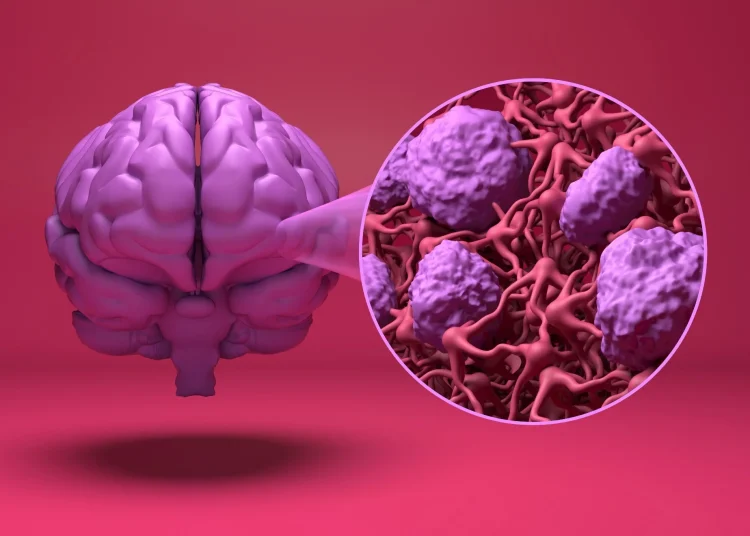 Study: Blood–brain barrier crossing of antihypertensives and risk of dementia: a comparative analysis. Image Credit: Nemes Laszlo / Shutterstock
