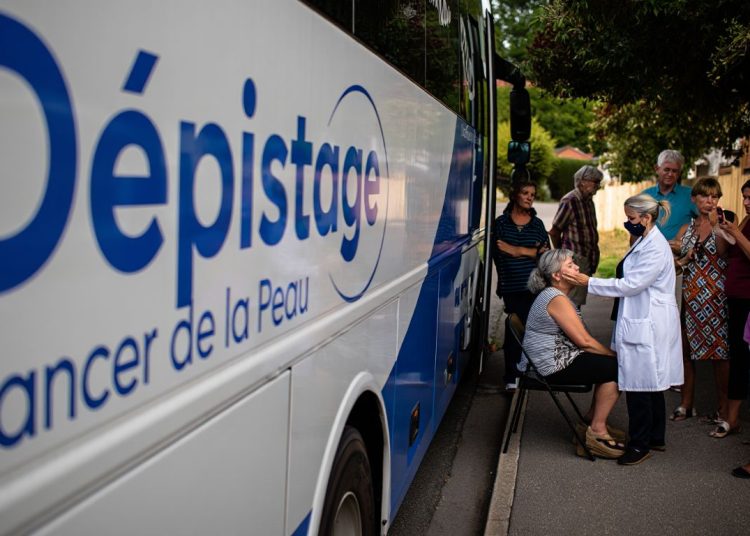 Ce département lance un bus de dépistage itinérant pour les cancers de la peau