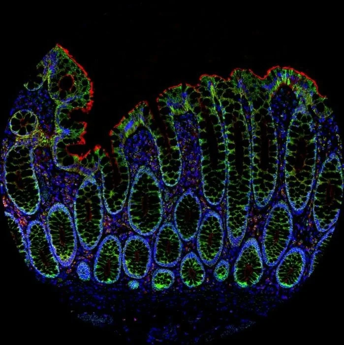 AtlasPlex™ apporte une IHC 5-plex personnalisée sur tissu FFPE en une seule journée