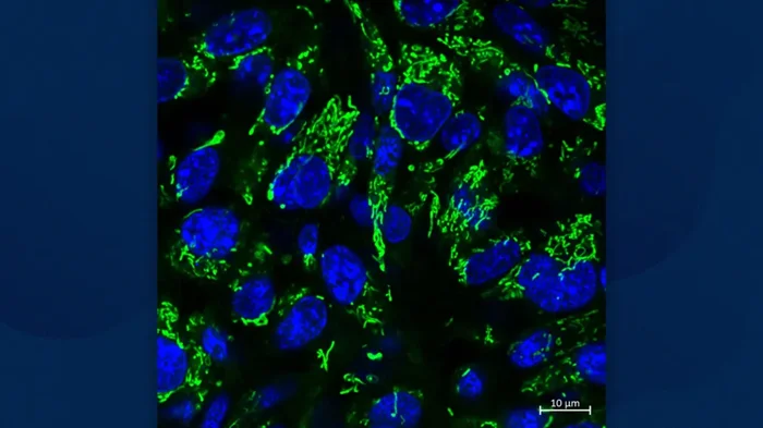 Des nanoparticules artificielles sensibilisent les gliomes à la radiothérapie