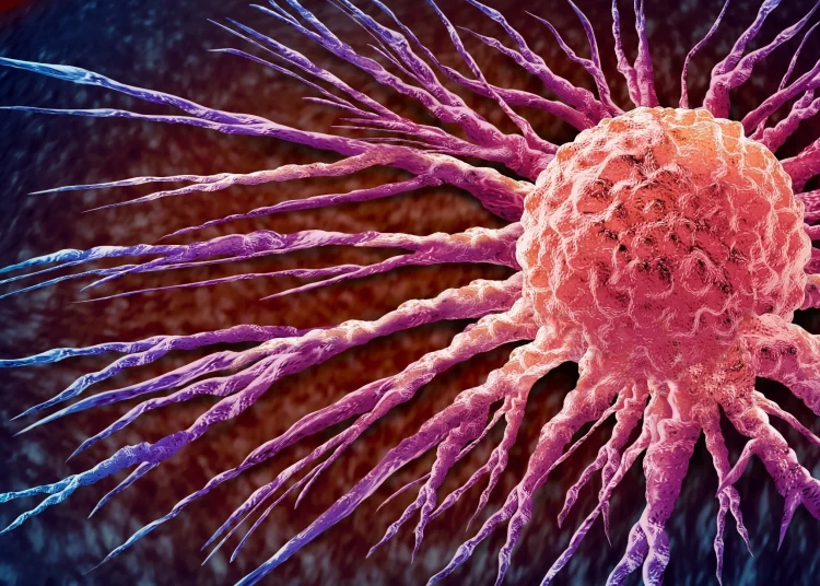 A comparative study of large language models in responding to breast cancer–related questions. Image Credit: Lightspring / Shutterstock