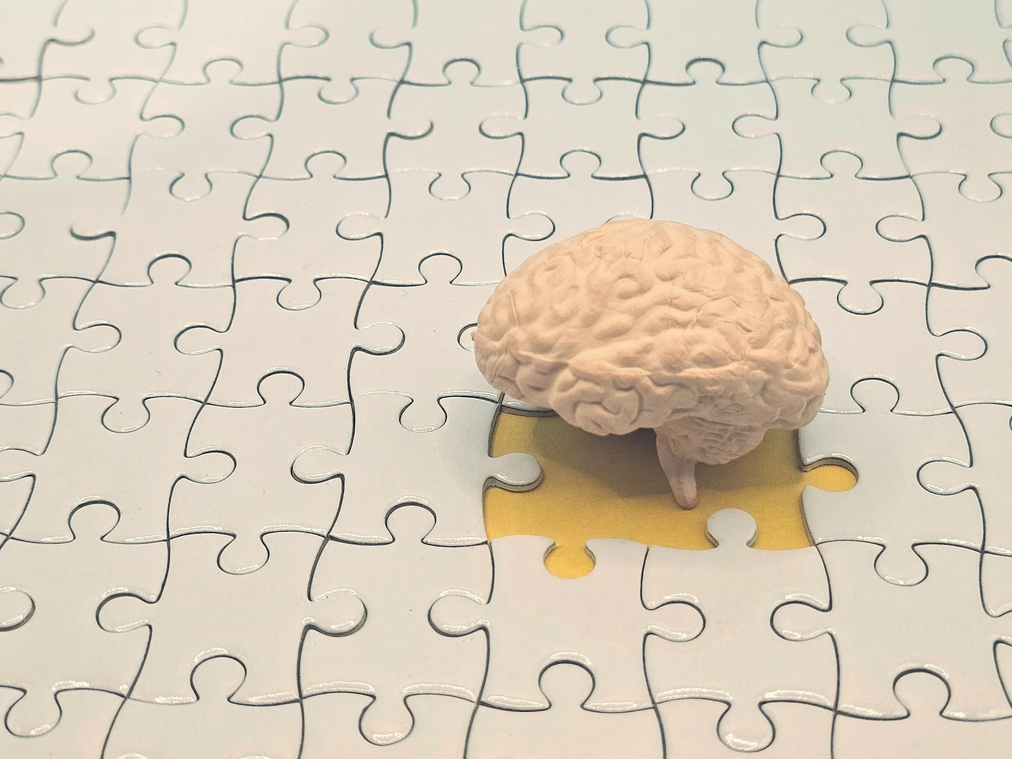 Study: Associations of physical fitness with brain structure, pathology and cognition in cognitively normal older adults. Image Credit: Efkaysim / Shutterstock