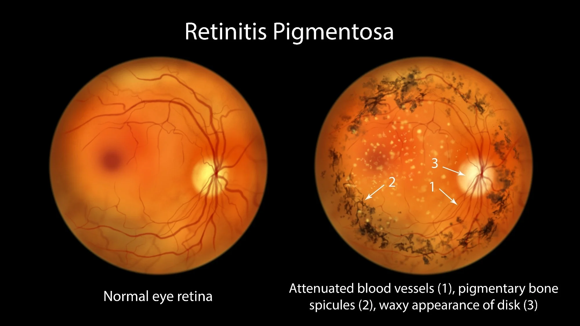 Study: Optogenetic Therapy for Restoring Aspects of Visual Function. Image Credit: Kateryna Kon / Shutterstock