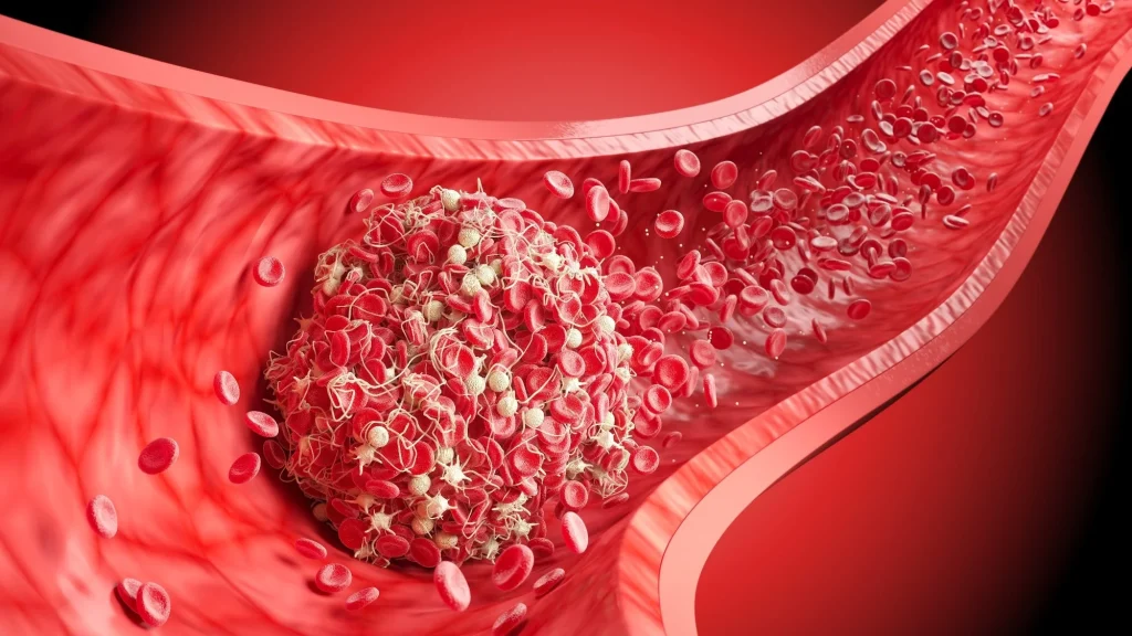 Association between coffee consumption and risk of recurrent venous thromboembolism – Results from the Trøndelag Health Study and Tromsø Study. Image Credit: Anusorn Nakdee / Shutterstock