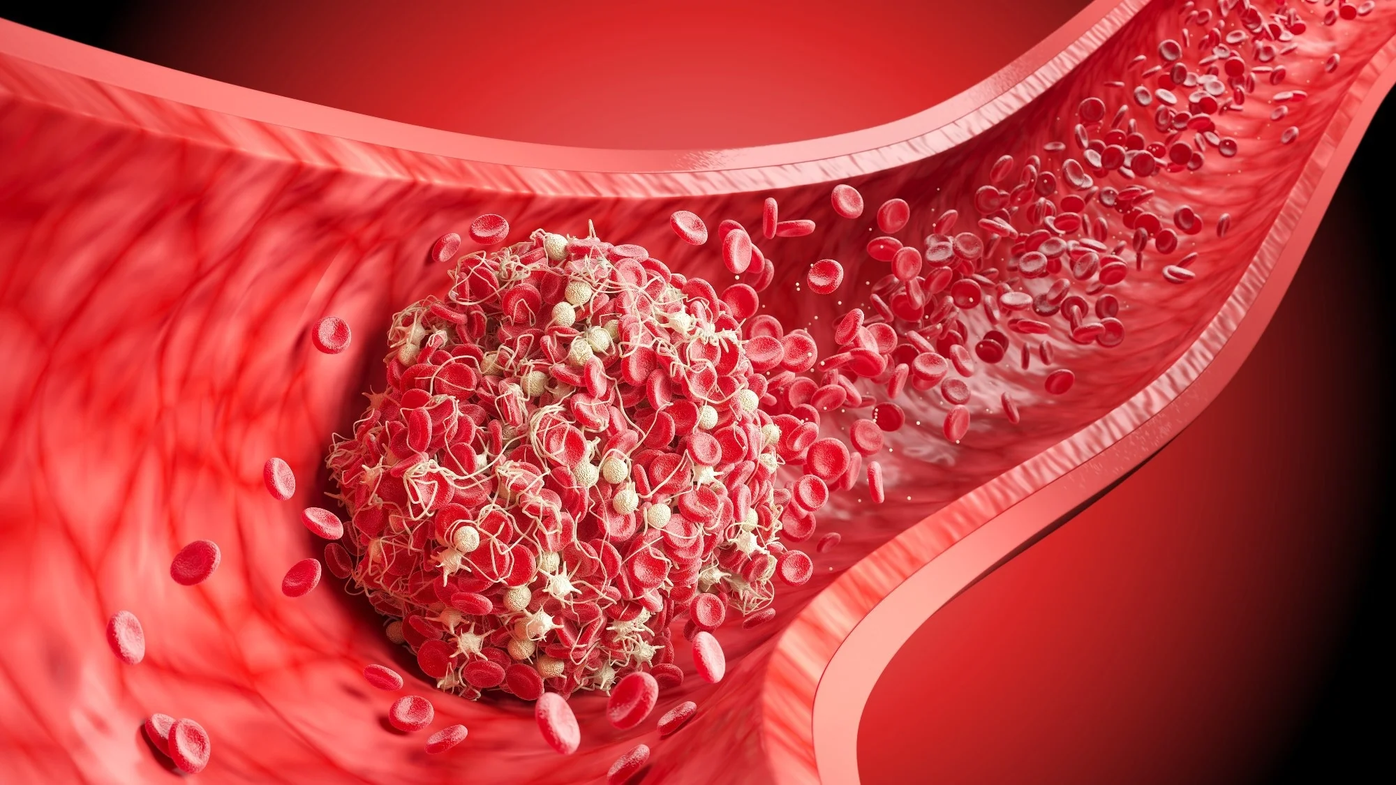 Association between coffee consumption and risk of recurrent venous thromboembolism – Results from the Trøndelag Health Study and Tromsø Study. Image Credit: Anusorn Nakdee / Shutterstock