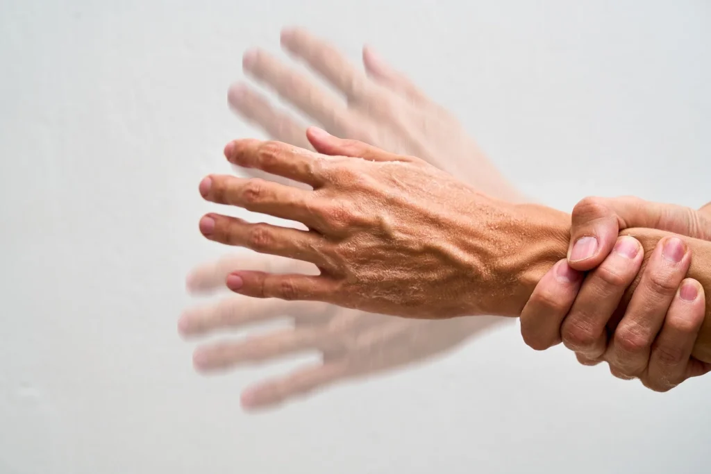 Study: Nicotinamide Riboside for Patients With Early-Stage Parkinson Disease. Image Credit: Fabian Montano Hernandez / Shutterstock